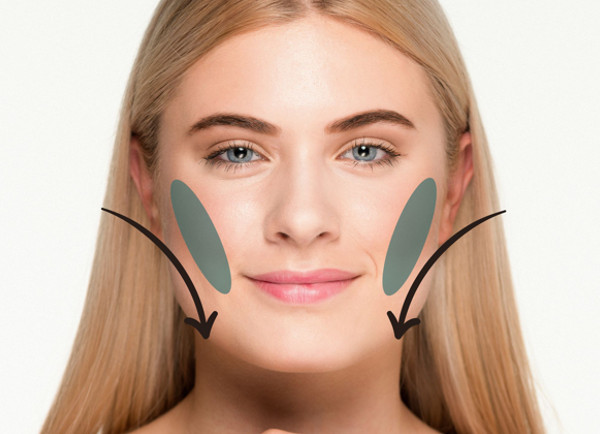 v shape zostihlenie masseter